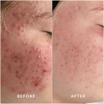 Epicutis Lipid Serum