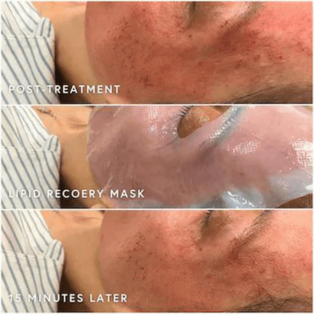 Epicutis Lipid Serum