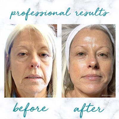 Neogenesis Recovery Serum