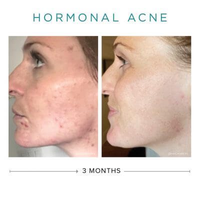Neogenesis Recovery Serum