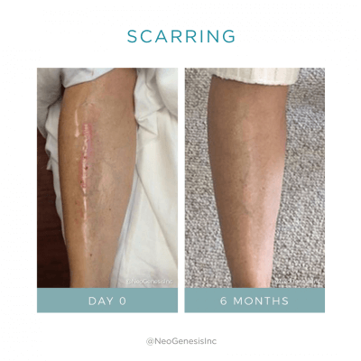 Neogenesis Recovery Serum