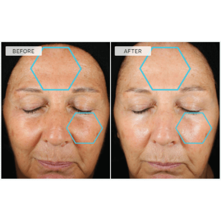Dermaquest Advanced B5 With Ferulic Acid